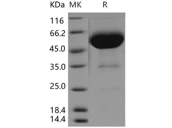 Human CD47 Recombinant Protein (RPES5243)