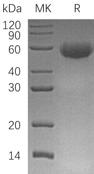 Human CD46 Recombinant Protein (RPES5245)