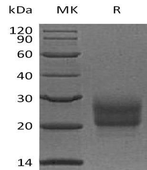 Human NCR3/NKp30 Recombinant Protein (RPES5247)