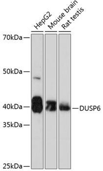 Anti-DUSP6 Antibody (CAB0133)
