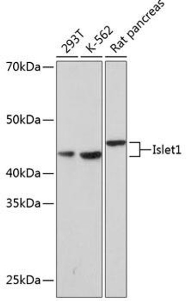 Anti-Islet1 Antibody (CAB0871)