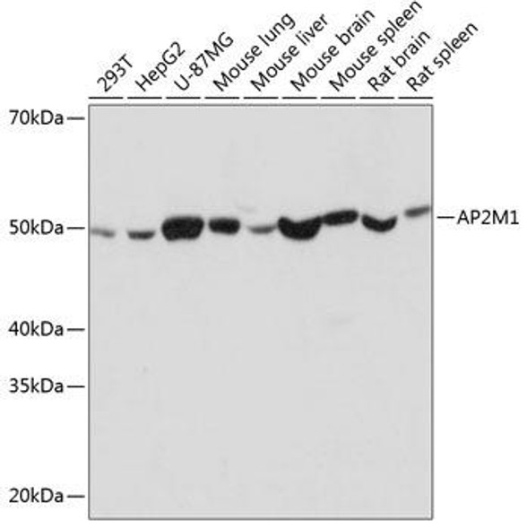 Anti-AP2M1 Antibody (CAB11070)