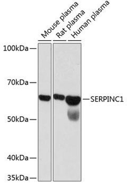 Anti-SERPINC1 Antibody (CAB11249)