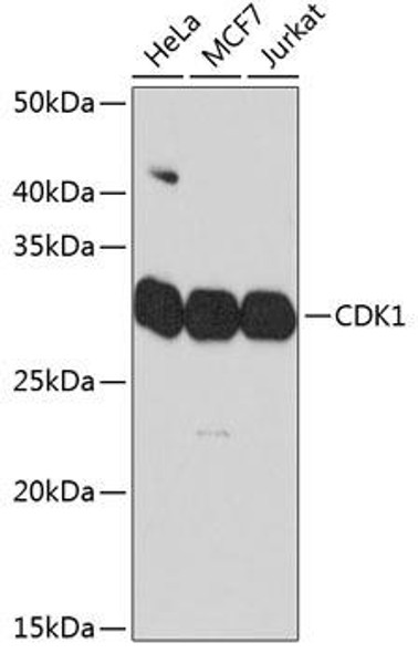 Anti-CDK1 Antibody (CAB11420)