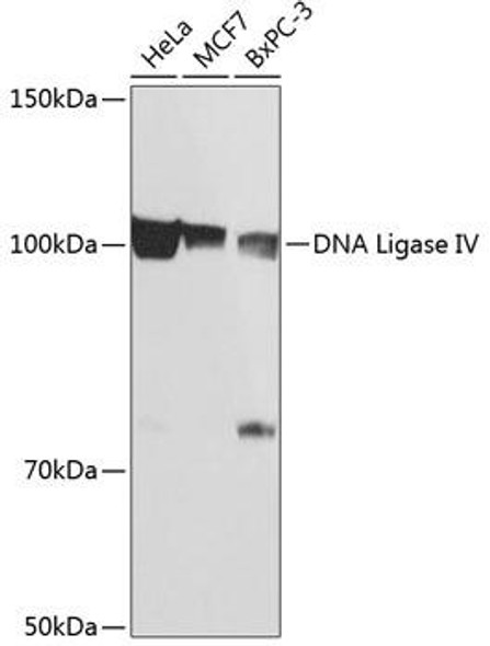 Anti-DNA Ligase IV Antibody (CAB11432)