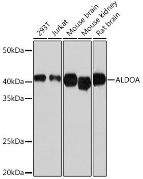 Anti-ALDOA Antibody (CAB11445)