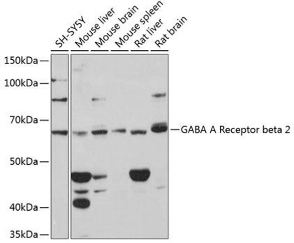 Anti-GABA A Receptor beta 2 Antibody (CAB11558)