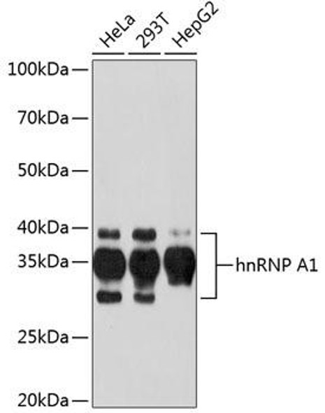 Anti-hnRNP A1 Antibody (CAB11564)