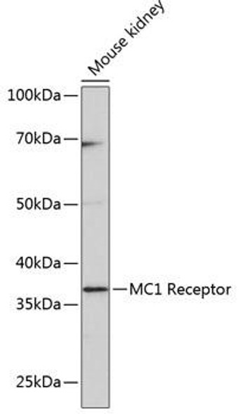 Anti-MC1 Receptor[KO Validated] Antibody (CAB11594)