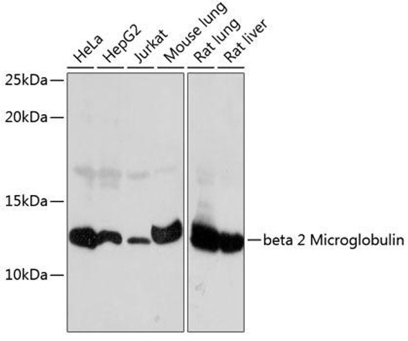 Anti-beta 2 Microglobulin Antibody (CAB11642)