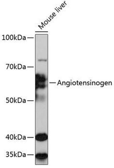 Anti-Angiotensinogen Antibody (CAB11689)