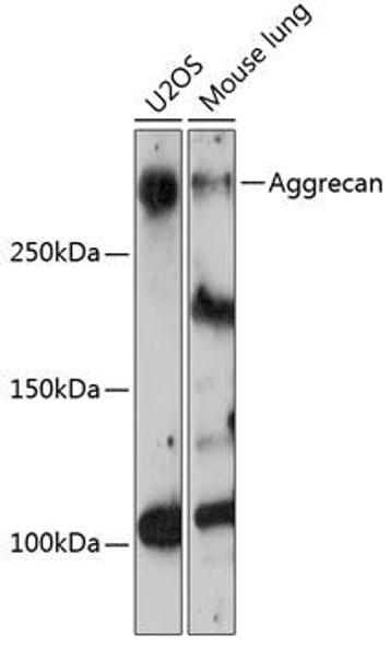 Anti-Aggrecan Antibody (CAB11691)