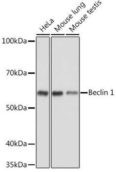 Anti-Beclin 1 Antibody[KO Validated]  (CAB11761)