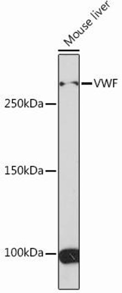 Anti-VWF Antibody (CAB13523)