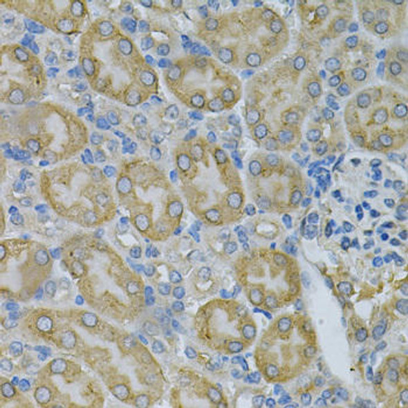 Anti-F8 Antibody (CAB13979)