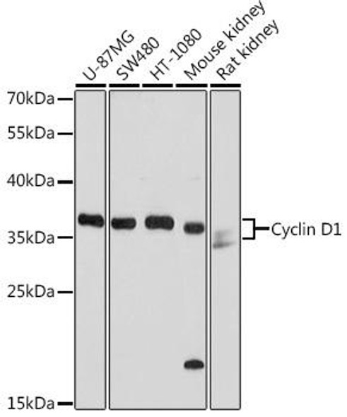 Anti-Cyclin D1 Antibody (CAB1301)