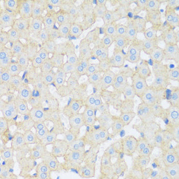 Anti-ASGR1 Antibody (CAB16766)