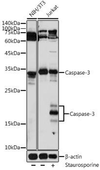 Anti-Caspase-3 Antibody (CAB16794)[KO Validated]