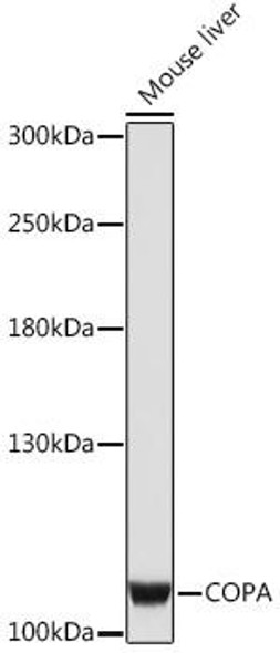 Anti-COPA Antibody (CAB16821)