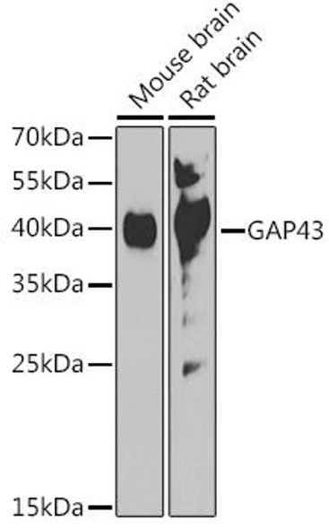 Anti-GAP43 Antibody (CAB16857)