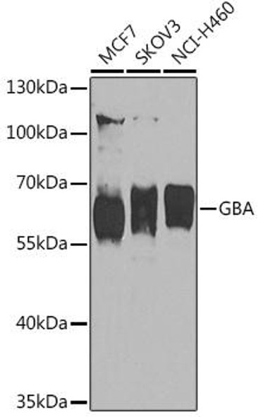 Anti-GBA Antibody (CAB16860)