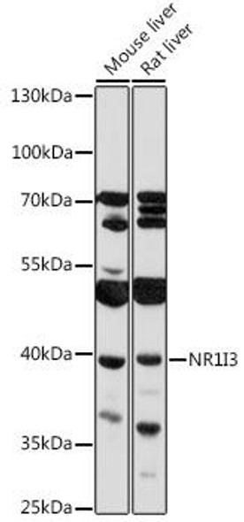 Anti-NR1I3 Antibody (CAB17066)