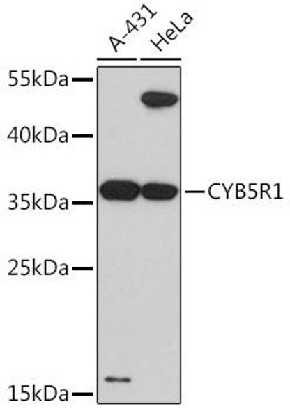 Anti-CYB5R1 Antibody (CAB17160)