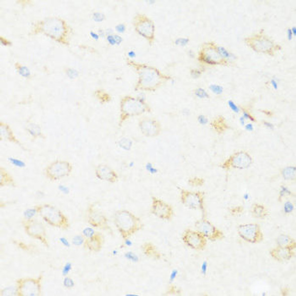 Anti-ASIC4 Antibody (CAB17179)