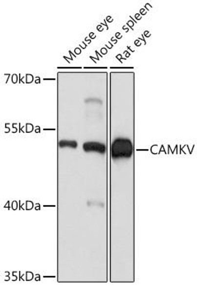 Anti-CAMKV Antibody (CAB17210)