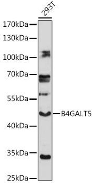 Anti-B4GALT5 Antibody (CAB17590)