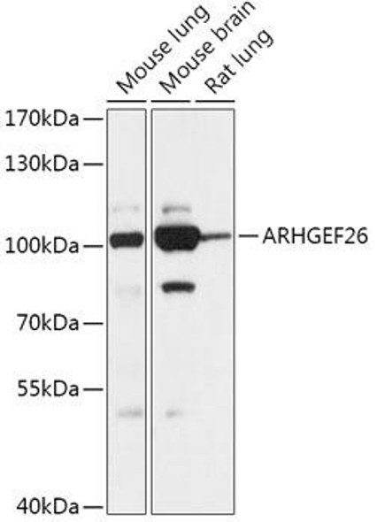 Anti-ARHGEF26 Antibody (CAB17677)