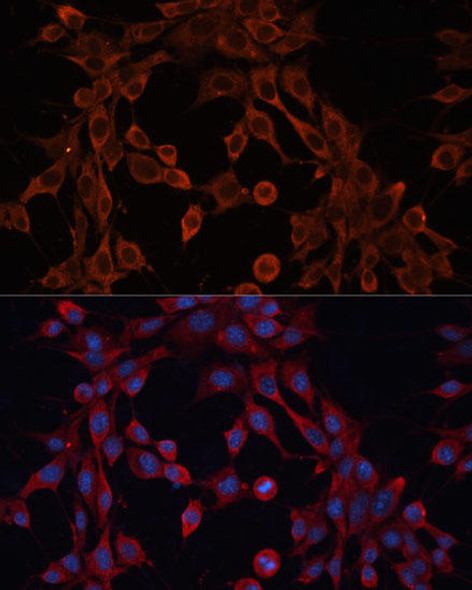 Anti-ABCA12 Antibody (CAB17680)