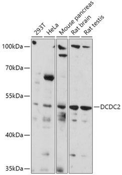 Anti-DCDC2 Antibody (CAB17704)