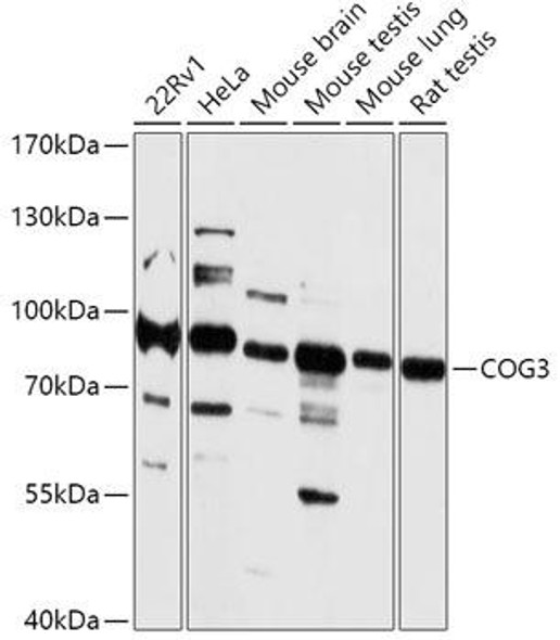 Anti-COG3 Antibody (CAB17785)