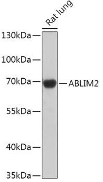 Anti-ABLIM2 Antibody (CAB17792)