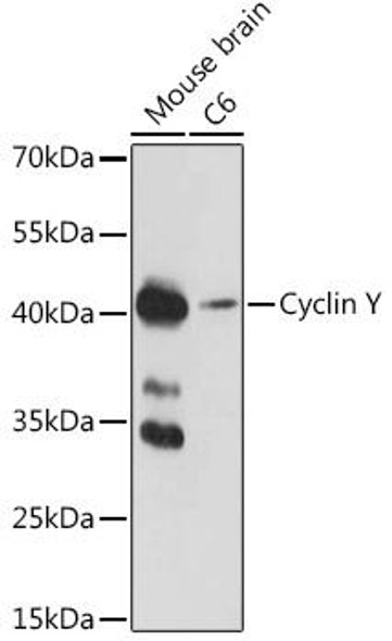 Anti-Cyclin Y Antibody (CAB17845)