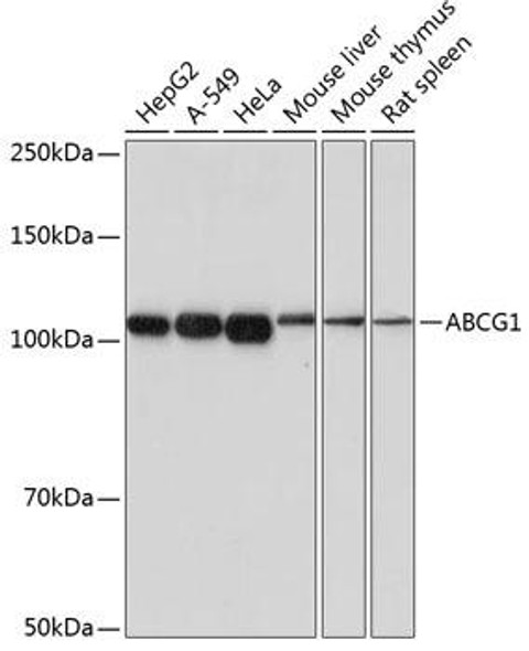 Anti-ABCG1 Antibody (CAB17907)