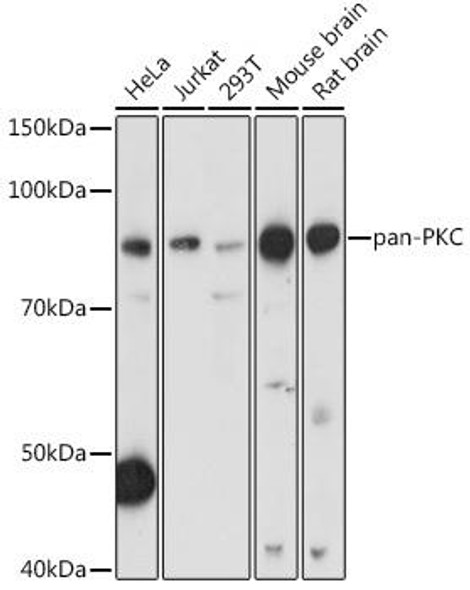 Anti-pan-PKC Antibody (CAB17922)