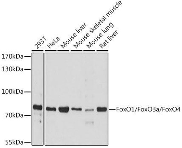Anti-FoxO1/FoxO3a/FoxO4 Antibody (CAB17978)