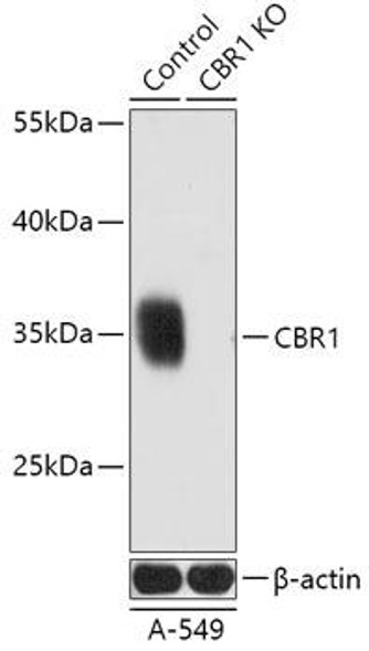 Anti-CBR1 Antibody (CAB18074)[KO Validated]
