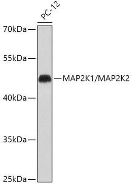 Anti-MEK1/MEK2 Antibody (CAB18117)
