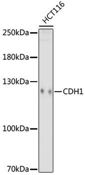 Anti-E-Cadherin Mouse Monoclonal Antibody (CAB18135)