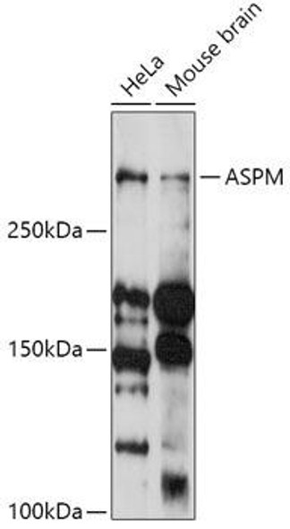 Anti-ASPM Antibody (CAB18147)