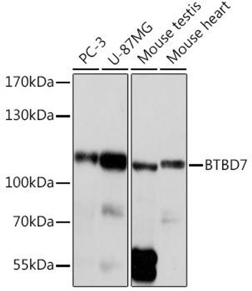 Anti-BTBD7 Antibody (CAB18206)