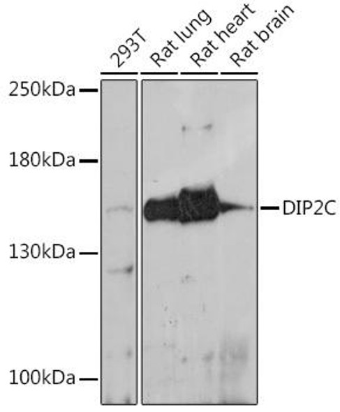 Anti-DIP2C Antibody (CAB18352)