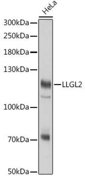 Anti-LLGL2 Antibody (CAB18366)