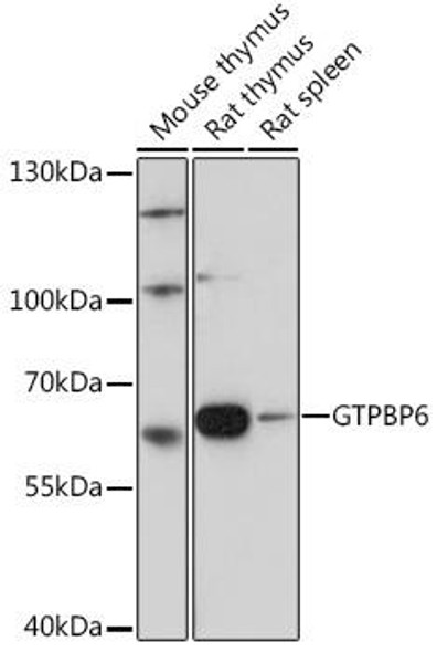 Anti-GTPBP6 Antibody (CAB18392)