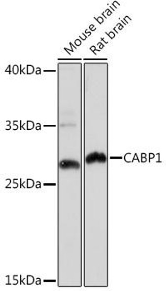 Anti-CABP1 Antibody (CAB18406)