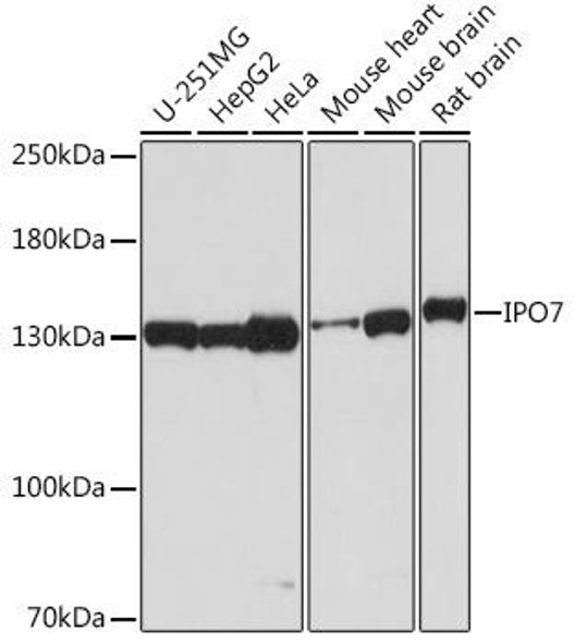 Anti-IPO7 Antibody (CAB18417)