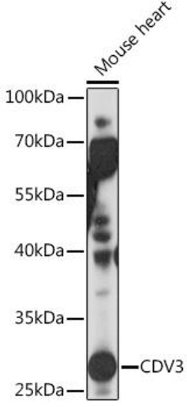 Anti-CDV3 Antibody (CAB18472)